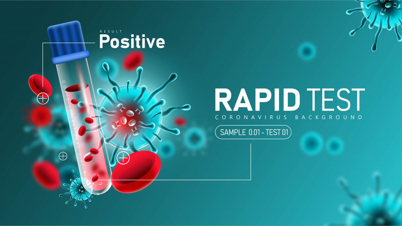 Test Covid-19: Cipro è al secondo posto tra i paesi dell'Unione Europea